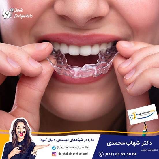 نایت گارد